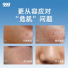 999 阿达帕林凝胶0.1*21g维a酸乳膏第三代祛痘膏去闭口粉刺痤疮祛痘凝胶青春痘丘疹脓疱痘印坑修复暗疮药膏,去粉刺,寻常型痤疮,轻中度寻常型痤疮,毛囊炎 实拍图