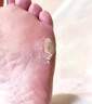 百易方去脚底老茧去硬皮软化膏茧子去除脚钉去脚根底厚后跟去茧王软化膏 一盒装*【发货特效快】 脚部 软化角质 去死皮 实拍图