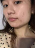 维特丝壬二酸祛痘药膏祛痘修复淡痘印烟酰胺凝胶水杨酸胶态硫青春期学生 实拍图