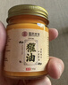 Mediviz獾子油烫伤膏冻疮烫伤起泡烫伤非止痒冻伤膏专用特效膏成人儿童 实拍图