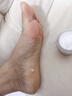 宝芝林香港脚气软膏止痒脱皮烂脚丫真菌感染脚臭狼毒除臭杀菌非喷雾剂 实拍图