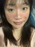 维特丝水杨酸祛痘精华淡化痘印去痘痘收毛孔男女士护肤品青春期学生专用 实拍图