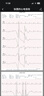 鱼跃（Yuwell）六导联心电记录仪心电监护仪医用高精准心电监测38节礼物ECG-C03 实拍图