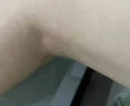 [拜都帮]曲安奈德益康唑乳膏 汗斑花斑癣专用药汗斑专用药(发货特效)真菌感染皮肤用药皮肤白斑汗斑净 曲安奈德益康唑乳膏1支+盐酸特比萘芬喷雾剂1瓶 实拍图