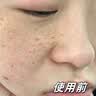 DR.NEUER熊果苷乳膏去黑色素烟酰胺祛斑霜雀斑晒斑提亮减黄改善暗沉女2支 实拍图