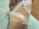 蓝洛 医用弹性自粘绷带学生护指防磨手指绷带弹力胶布贴包扎纱布绷带 实拍图