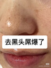 白云山清洁面膜壬二酸泥膜棒去黑头粉刺祛痘去角质收缩毛孔控油 实拍图