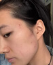 藤石制药激光点痣后脸部去红印黑印凹陷修复凝胶祛痣疤痕膏淡化红印色素DS 两盒装第二盒半价 实拍图