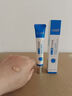 OHBT壬二酸祛痘药膏水杨酸凝胶祛痘痘和淡化痘印坑消炎痤疮专用青少年 实拍图