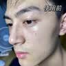 初蔓洗面奶男士专用控油祛痘除螨去黑头收缩毛孔深层清洁氨基酸洁面乳 【控油祛痘】魅蓝男士洗面奶250g 商超热卖男士洗面奶TOP 实拍图