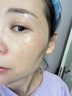 维特丝377面霜乳液男女士美白祛斑抗皱高保湿补水去黄提亮黑色素护肤品 实拍图