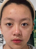五羊（FIVERAMS）青少年控油祛痘修护面霜12-18岁男女孩初高中学生青春期护肤品50g 实拍图