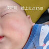 AIDERUI埃德瑞德国婴儿宝宝湿疹膏口水疹专用无激素0-3岁皮肤瘙痒皮炎真菌药监 实拍图
