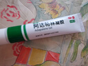 丽芙阿达帕林凝胶16g/盒第三代维a酸乳膏医用祛痘印修复淡化痘印痘坑修复祛痘药膏去黑头收缩毛孔粗大修复 实拍图