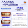 沃朗森牙贴美白牙齿去黄神器贴片去口臭变漂洁亮白牙膜牙周护理去渍酵素 实拍图