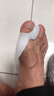 FIT MOMENT大拇指外翻矫正器医用脚趾矫正器成人儿童脚趾头分趾器硅胶可穿鞋 实拍图