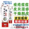 牛皮癣白癣皮软膏股癣大腿内侧阴囊私处瘙痒花斑癣荨麻手足癣真菌感染止痒膏皮肤瘙痒皮炎湿疹鹅掌风干裂脱皮 顽藓净抑菌膏 【20g/盒】 实拍图