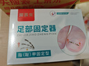 Dr.JYS甲沟炎矫正器镍钛合金正甲贴片嵌甲专用脚趾甲长肉里足部固定器 实拍图