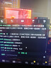 德众复方珍珠暗疮片 84片 清热解毒 凉血消斑 祛痘消炎痤疮专用 粉刺湿疮红斑脓疱疙瘩丘疹瘙痒痤疮  实拍图