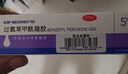 【原研好药】班赛 过氧苯甲酰凝胶5%（15g：0.75g）* 15g 医用祛痘消炎药膏去痤疮粉刺消红肿痘痘药法国进口 实拍图