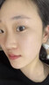 藤石制药激光点痣后脸部去红印黑印凹陷修复凝胶祛痣疤痕膏淡化红印色素DS 单盒装 实拍图
