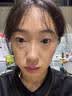 白云山咖啡啡因多肽淡纹眼膏淡化细纹提拉紧致抗皱去黑眼圈眼袋医用正品 一盒【因咖啡多肽淡纹眼膏去黑眼圈】 实拍图
