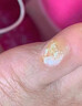 百易方去脚底老茧去硬皮软化膏茧子去除脚钉去脚根底厚后跟去茧王软化膏 一盒装*【发货特效快】 脚部 软化角质 去死皮 实拍图