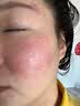 薇诺娜（WINONA）特护霜舒敏保湿屏障修护面霜乳液敏感肌护肤品男女生日礼物 【干皮适用】特护滋润霜50g第二代 实拍图