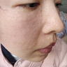 韩国海飞六代不漏液负压水光机八代家用美容器自打水光珍仪器美容 【升级旗舰版十代】+1套耗材 实拍图