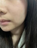 藤石制药激光点痣后脸部去红印黑印凹陷修复凝胶祛痣疤痕膏淡化红印色素DS 两盒装第二盒半价 实拍图