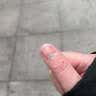 惜药师液体敷料指甲淤血敷料脚趾甲淤血药手指甲床受伤淤血黑脚趾甲保护 京自仓100%特效发货 【30ml/盒】 医用指甲淤血液体敷料 实拍图