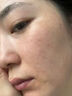 维特丝水杨酸祛痘精华淡化痘印去痘痘收毛孔男女士护肤品青春期学生专用 实拍图