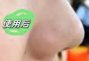 TRUVOER德国黑头铲超声波去黑头仪电动吸黑头神器毛孔清洁导入导出去粉刺神器美容仪生日礼物纪念日送女生 顶配款【LED红蓝光护肤+细嫩毛孔+离子导出】 实拍图
