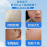 韶琪儿童脸上小疙瘩用的鸡皮肤去除神器毛周角化专用可搭药膏脸部20g 实拍图