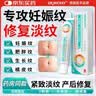 DR.MICKEY医用去妊娠纹产后霜祛疤膏疤痕孕妇专用修复凝胶消除预防生长纹油 实拍图