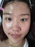 维特丝水杨酸祛痘精华淡化痘印去痘痘收毛孔男女士护肤品青春期学生专用 实拍图
