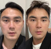 瑜然美眼部抗皱紧致精华油淡化细纹黑眼圈眼袋补水保湿男女滚珠20ml 实拍图