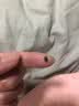 美容的院专用官的方正品点疣非药品水去痣点痣膏疤痕修复液非医用 一盒装 5g 1盒 实拍图