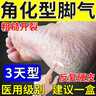 [福元]硝酸咪康唑乳膏 脚气药止痒脱皮烂脚丫真菌感染根药治脚脱皮抗真菌干裂脱皮脚后跟干裂膏角化型脚气 2%*20g 3盒装 【即速吸收多人选择】 实拍图