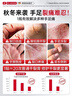 DR.LARSSNE 郎森博士马油凡士林干裂贴手足脚后跟干裂口愈合专用胶布手指开裂防皲裂贴 实拍图