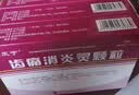 [雅风宁]齿痛消炎灵颗粒20g*4袋/盒 5盒装 实拍图