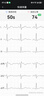 鱼跃（Yuwell）六导联心电记录仪心律失常房颤早筛查医用高精准监护仪器家用C03 实拍图