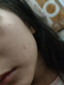 mederma美德玛儿童专用祛 疤膏20g 温和淡疤痕修护凝胶 德国进口 实拍图