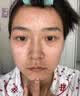 透真水杨酸精华液祛痘修复淡化痘印果酸控油除螨收缩毛孔去黑头护肤 实拍图