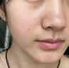 婴儿油收缩毛孔精华液去黑头深层清洁毛孔粉刺按摩保湿正品滋润油 100ml3瓶【婴儿椰子油】买2送1 实拍图