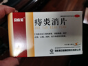 马应龙麝香痔疮膏20g+马应龙 痔炎消片 0.53g*10片*4板 痔疮便血肿痛 口服外用组合止血消肿 实拍图