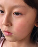 点痣后疤痕修复膏除疤膏凹坑增生凸起点痣后去脸上红印黑印激光术后点斑成人儿童专用修复淡化凝胶液 单盒【体验装】 实拍图