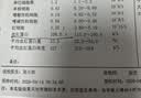 Swisse补铁片孕妇专用铁剂补气血益气养血气血不足孕期备孕哺乳期贫血 【母婴同补 缓解孕反】孕妇补铁片 30粒*1瓶 实拍图