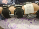 麦德威（medwe）医用膝关节固定支具碳纤维膝盖支架腿部骨折韧带术后护具MD177-14 实拍图