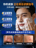 BEAUTY NOTES氨基酸洗面奶男士专用控油祛痘去黑头美白控油收缩毛孔深层清洁 实拍图